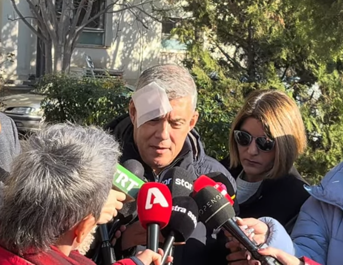 Ένταση στην Περιφέρεια Θεσσαλίας: Ο Κώστας Αγοραστός μιλά για απρόκλητη επίθεση από συγγενείς θυμάτων των Τεμπών